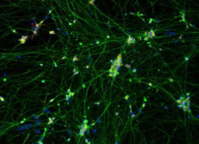 Quick-Neuron™ Dopaminergic - Human iPSC-derived Neurons (F, 74 yr donor) - Healthy Control