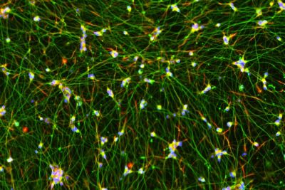 Excitatory Neurons ICC Image
