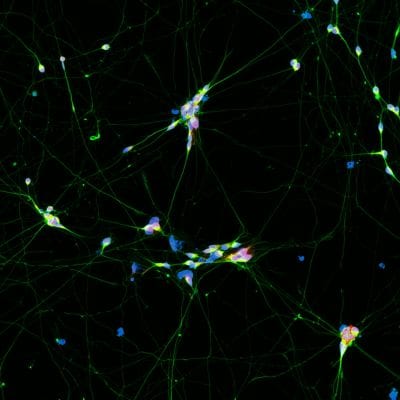 Quick-Neuron™ Cholinergic - mRNA Kit