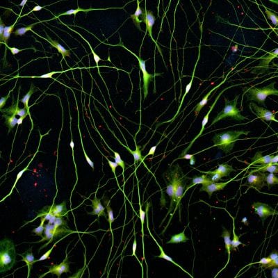 Quick-Neuron™ Cholinergic - Human iPSC-derived Neurons (F, 74 yr donor) - Healthy Control