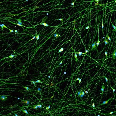 Quick-Neuron™ Excitatory - Human iPSC-derived Neurons Healthy Control - (F, 74yr, Caucasian, not Latino)
