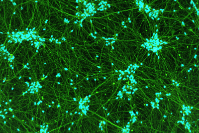 GABAergic Neurons ICC Image