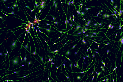 Cholinergic Neurons ICC Image