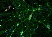 Dopaminergic Neurons ICC Image