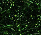 Motor Neurons ICC Image