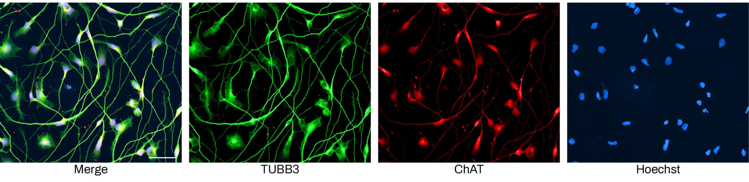 Immunofluorescent Cholinergic Neurons