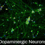 iPSC-derived Dopaminergic Neurons