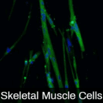 iPSC-derived Skeletal Muscle Cells