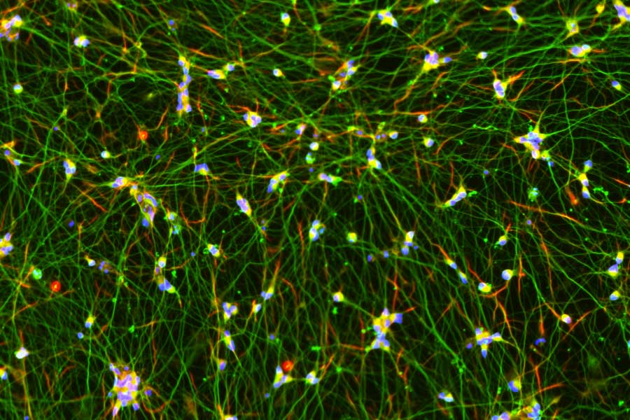 iPSC-derived Excitatory Neurons