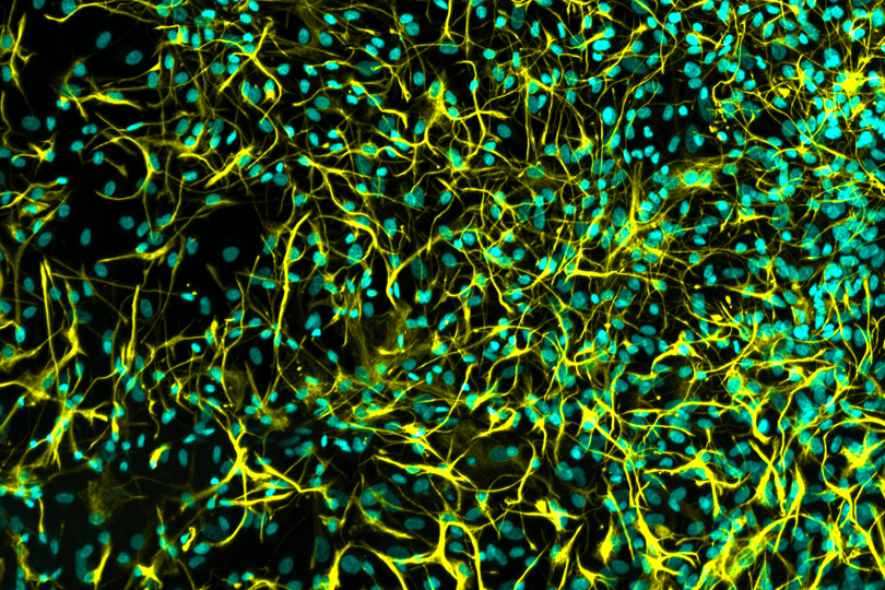 iPSC-derived Astrocytes