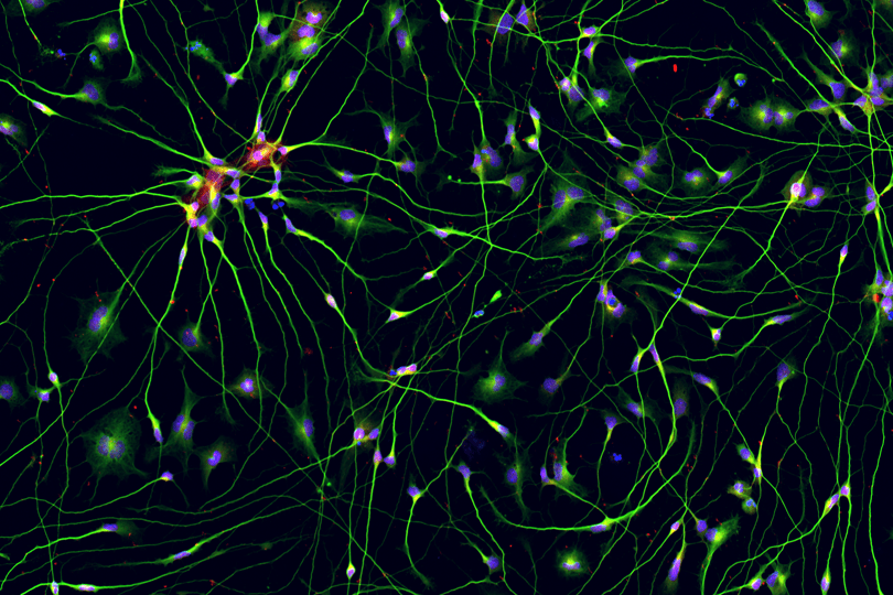 iPSC-derived Cholinergic Neurons