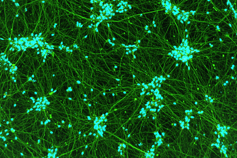 iPSC-derived GABAergic Neurons