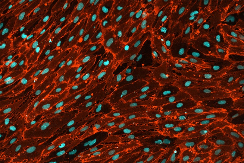 iPSC-derived Endothelial Cells