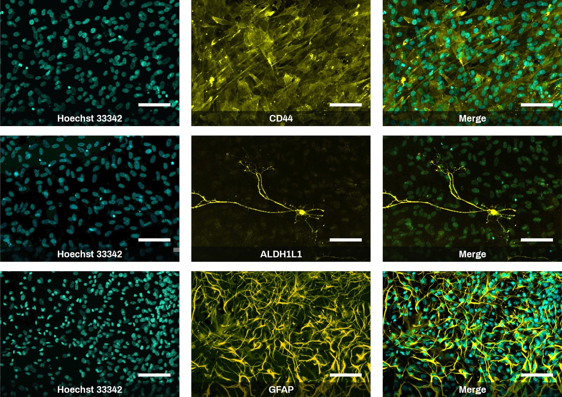 iPSC-derived Astrocyte ICC images