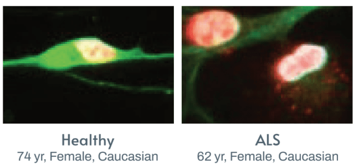 ALS TDP-43 mutant and control iPSC-derived Neurons