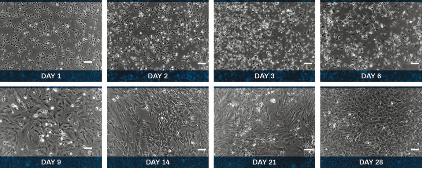 AS-SeV-S_phase-contrast