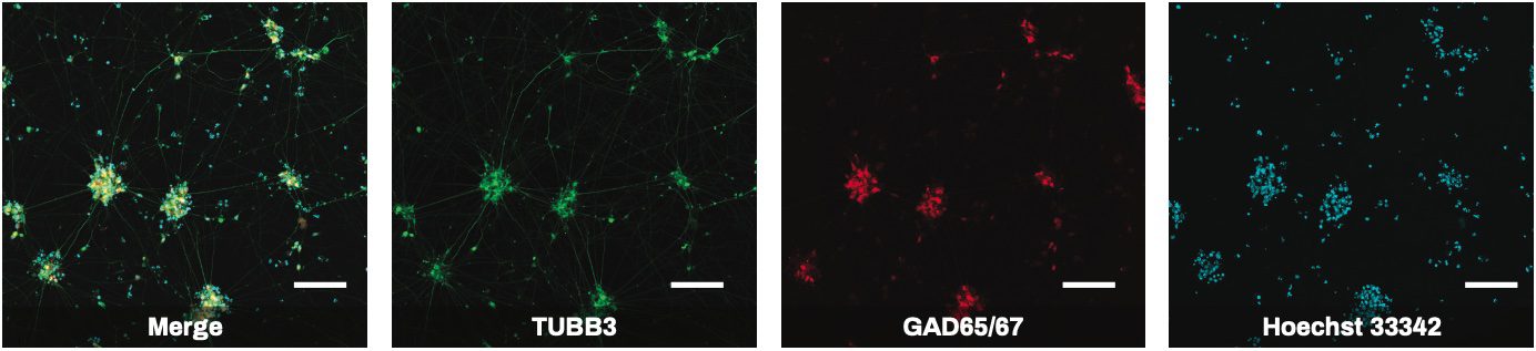 iPSC-derived GABAergic Neuron ICC images