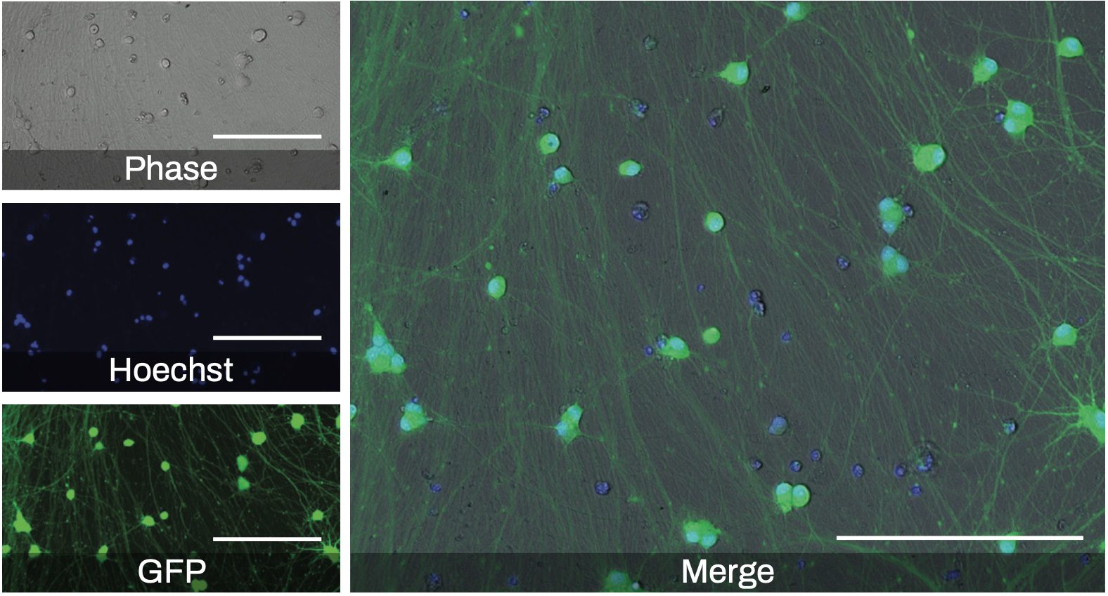 Visualizing Neurite Outgrowth by Lentiviral Transduction of Fluorescent Proteins into Human iPSC-derived Excitatory Neurons