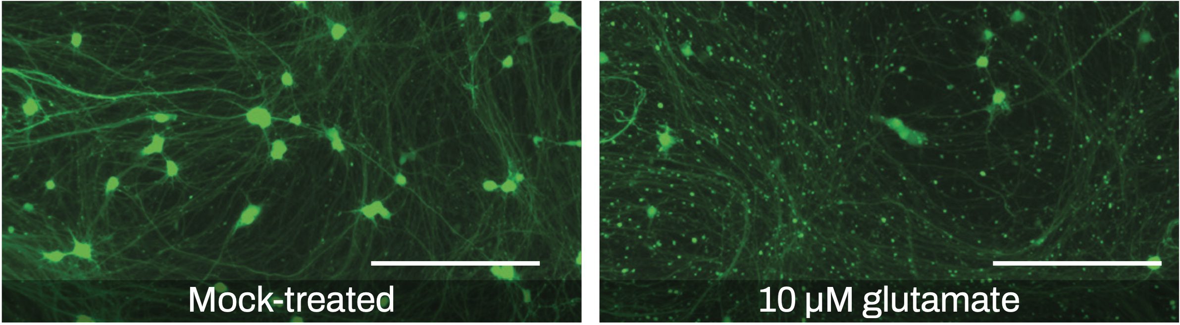 Visualizing Neurite Outgrowth by Lentiviral Transduction of Fluorescent Proteins into Human iPSC-derived Excitatory Neurons
