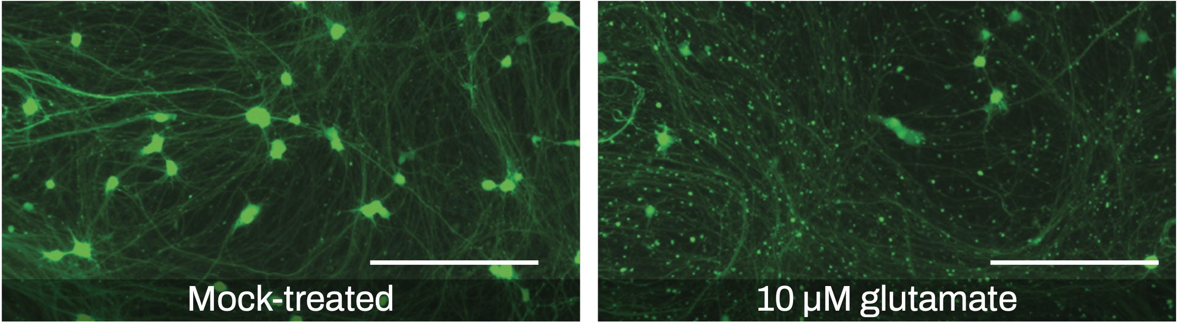 Visualizing Neurite Outgrowth by Lentiviral Transduction of Fluorescent Proteins into Human iPSC-derived Excitatory Neurons Visualizing Neurite Outgrowth by Lentiviral Transduction of Fluorescent Proteins into Human iPSC-derived Excitatory Neurons