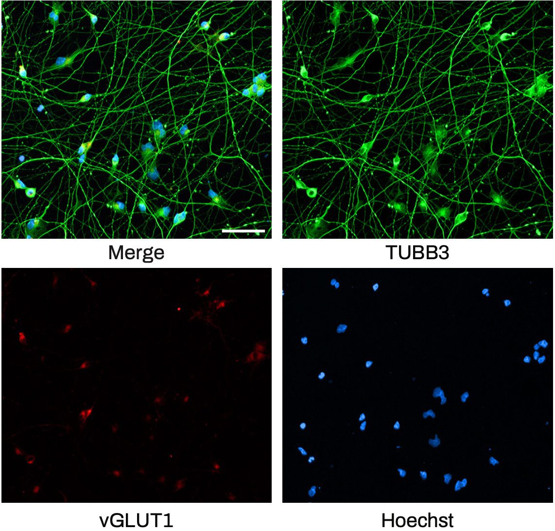 iPSC-derived Excitatory Neuron ICC images