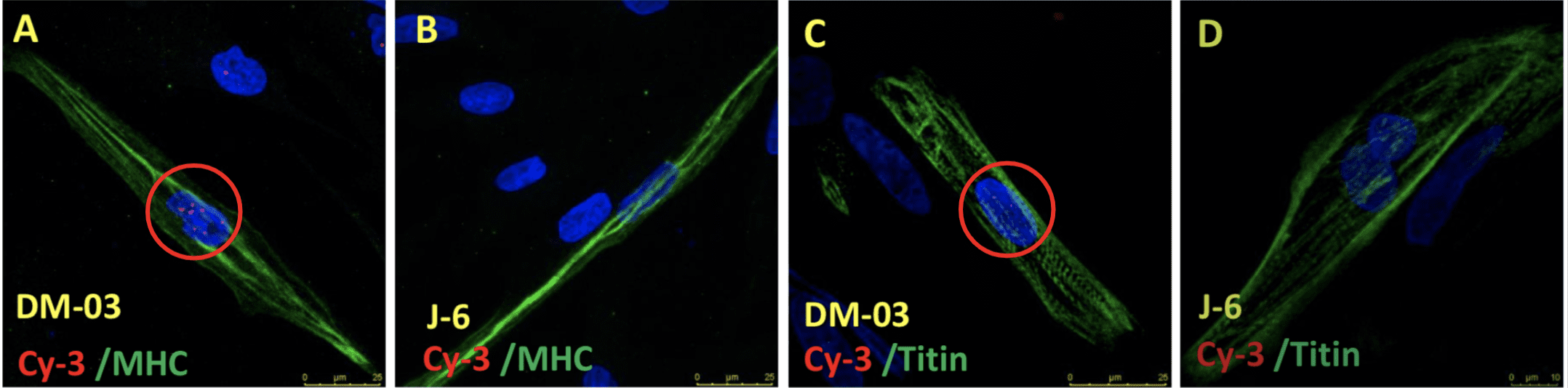 DMD and CRISPR corrected iPSC-derived Skeletal Muscle Cells