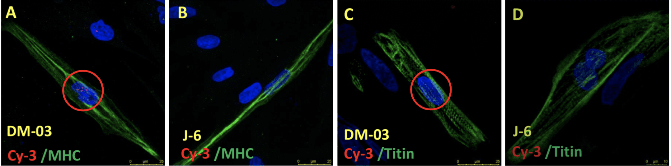 DMD and CRISPR corrected iPSC-derived Skeletal Muscle Cells DMD and CRISPR corrected iPSC-derived Skeletal Muscle Cells