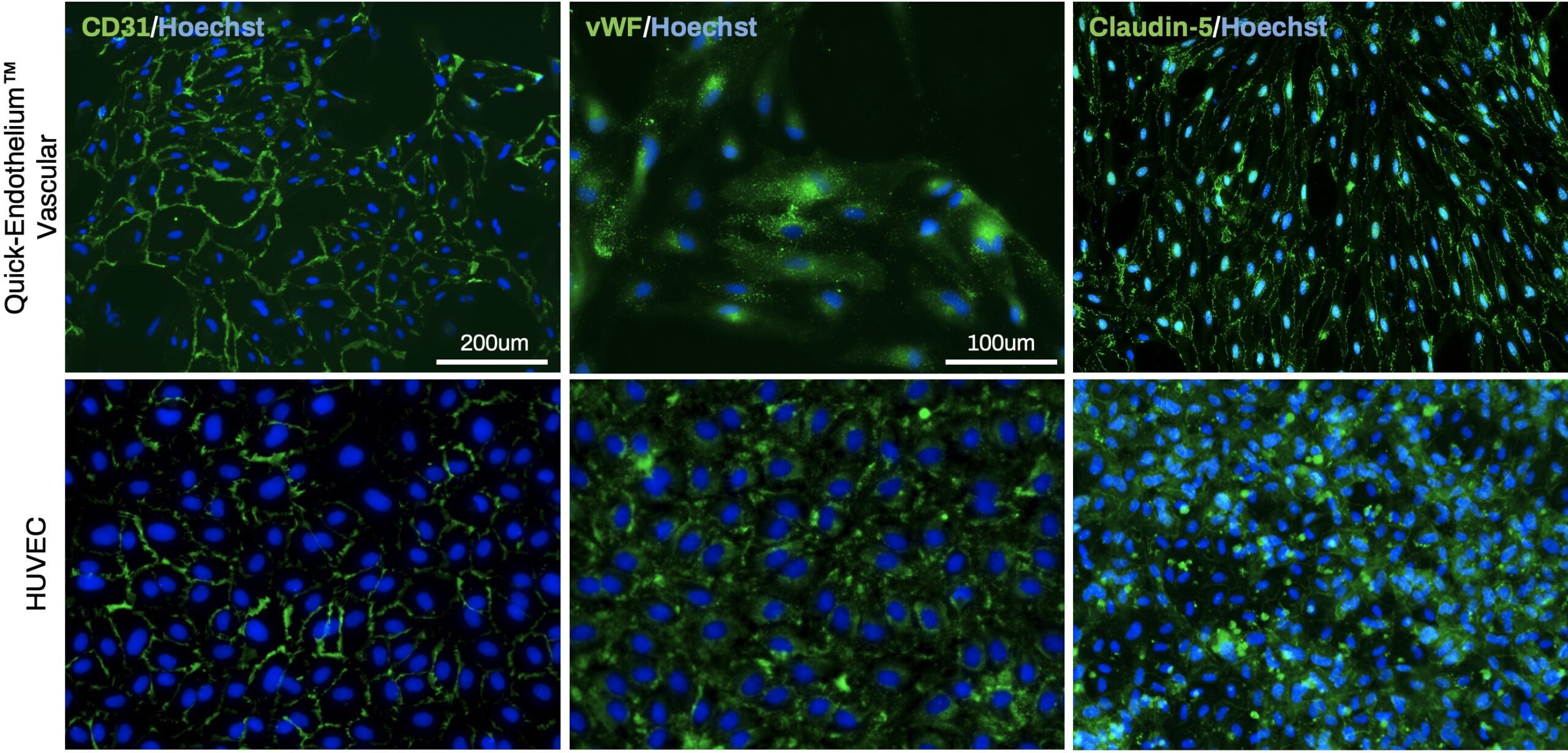 ICC image comparison between HuVEC and iPSC-derived Endothelial Cells
