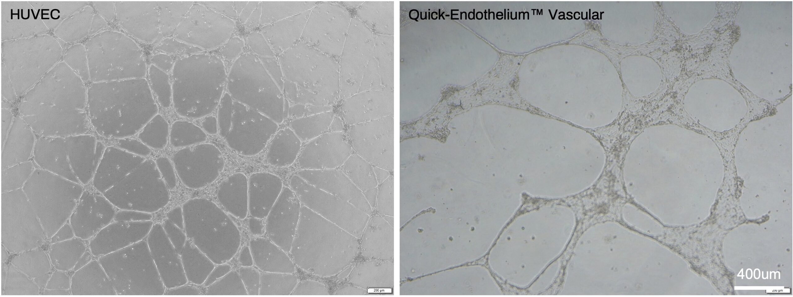 Tube formation comparison between HuVEC and iPSC-derived Endothelial Cells