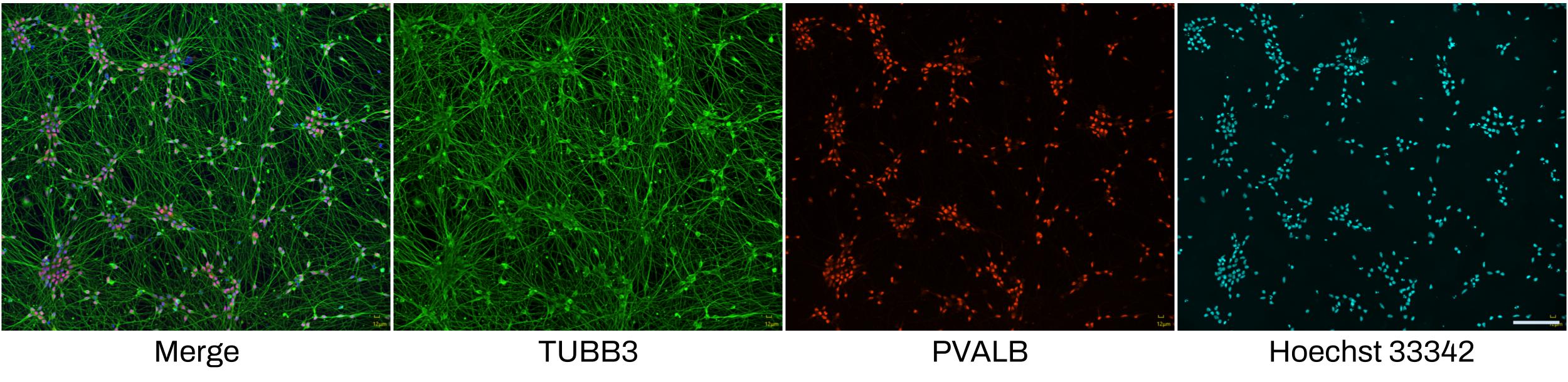 iPSC-derived GABAergic Neuron ICC images
