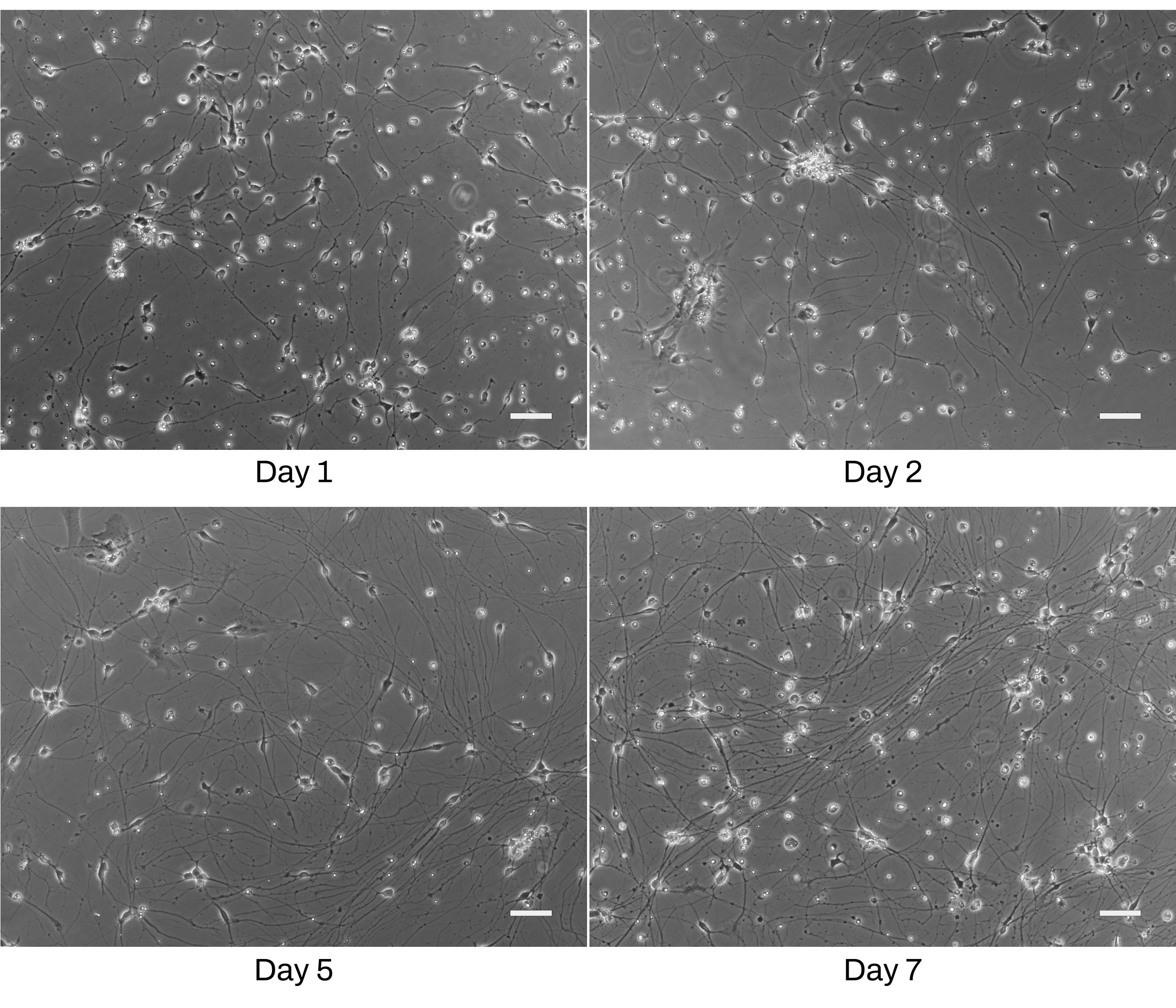 iPSC-derived GABAergic Neuron Phase contrast images