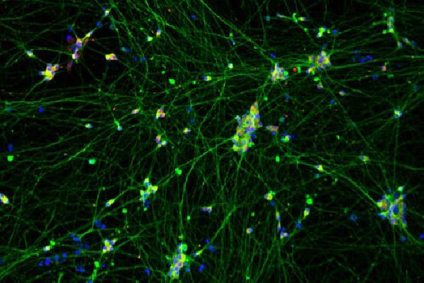 iPSC-derived Dopaminergic Neurons