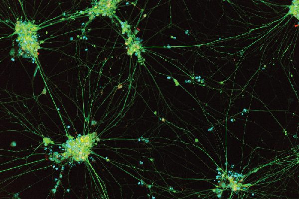 iPSC-derived Sensory Neurons