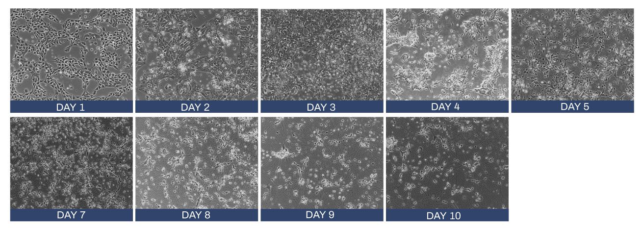 Elixirgen Scientific's Quick-Neuron™ GABAergic - mRNA Kit cell cultures