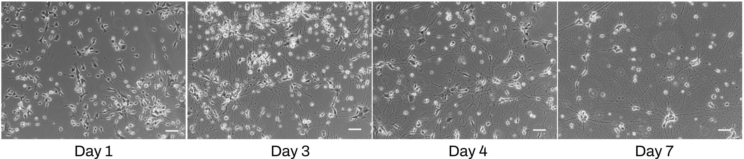 iPSC-derived Dopaminergic Neuron Phase Contrast Images