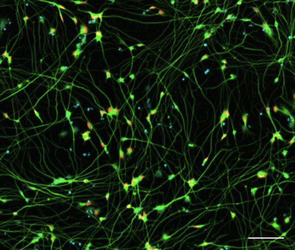 iPSC-derived Motor Neurons