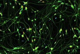iPSC-derived Motor Neurons