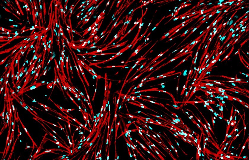 iPSC-derived Skeletal Muscle Cells