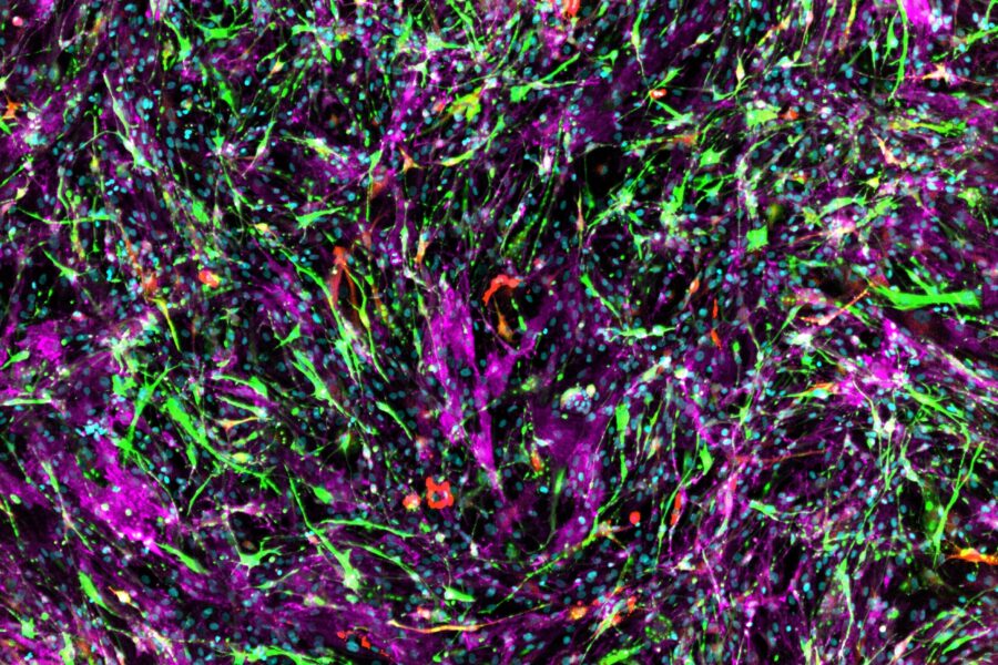 Merged immunocytochemistry images showing multiple markers for Astrocytes