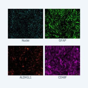 Immunocytochemistry images of markers GFAP, ALDH1L1, and More.